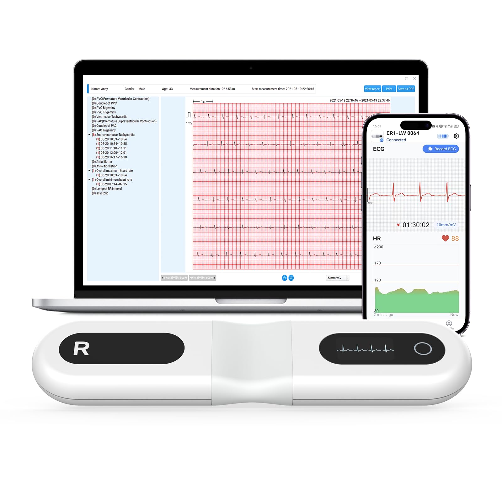 دستگاه مانیتور ECG آنالیز هوش مصنوعی با صفحه OLED ECG  ساعته 24 بلند مدت Wellue ER1-LW برای خانه، سازگار با iOS و Android، Mac و Windows، عملکرد نشانگر رویداد ECG